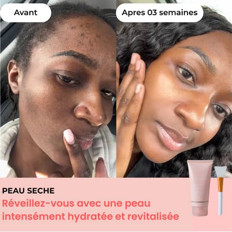 Masque Régénérant Kalkaire — Collagène Hydrolysé et Niacinamide