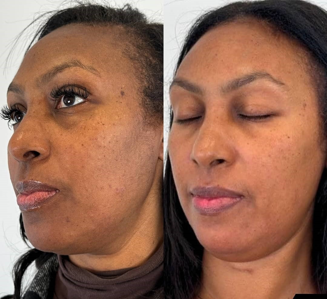 Avant et après utilisation de Kalkaire